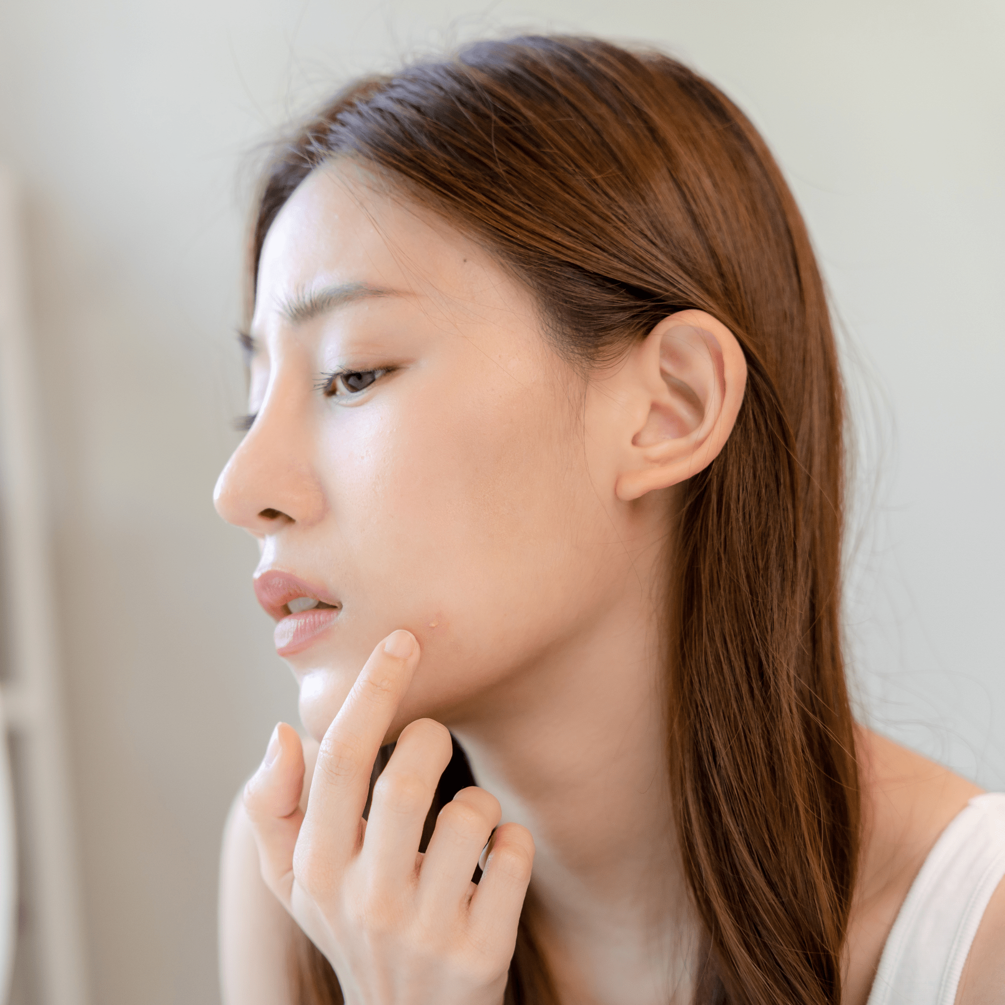 Combatting Blemish Prone Skin: Your Guide to a Clear Complexion - Claribelskincare.com