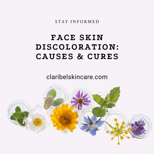 face skin discoloration