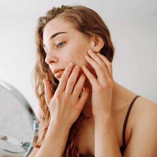 How to Care for Sensitive Skin Naturally and Safely - Claribelskincare.com