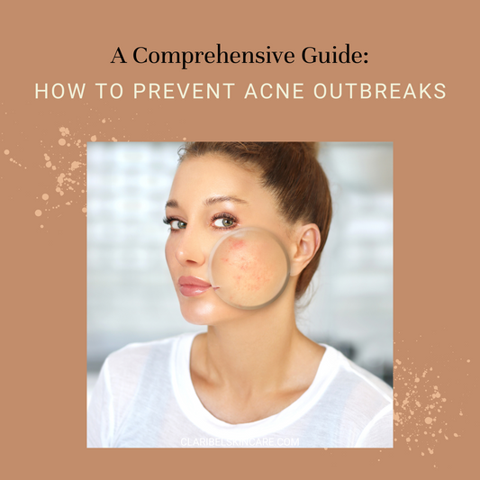 how to prevent acne outbreaks