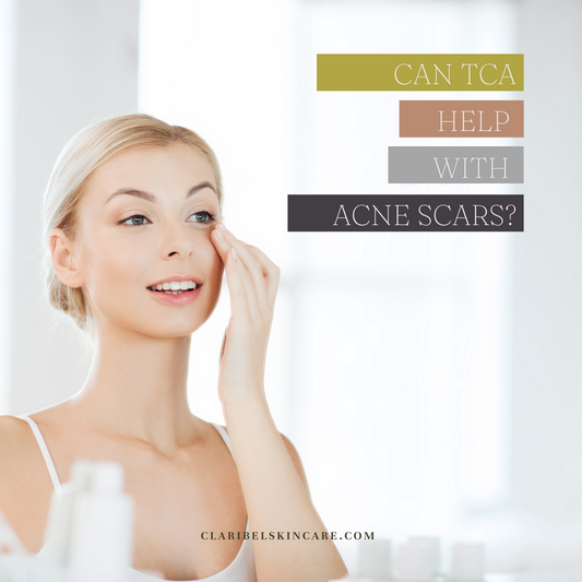 tca for acne scars