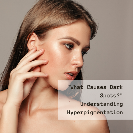 what causes dark spots